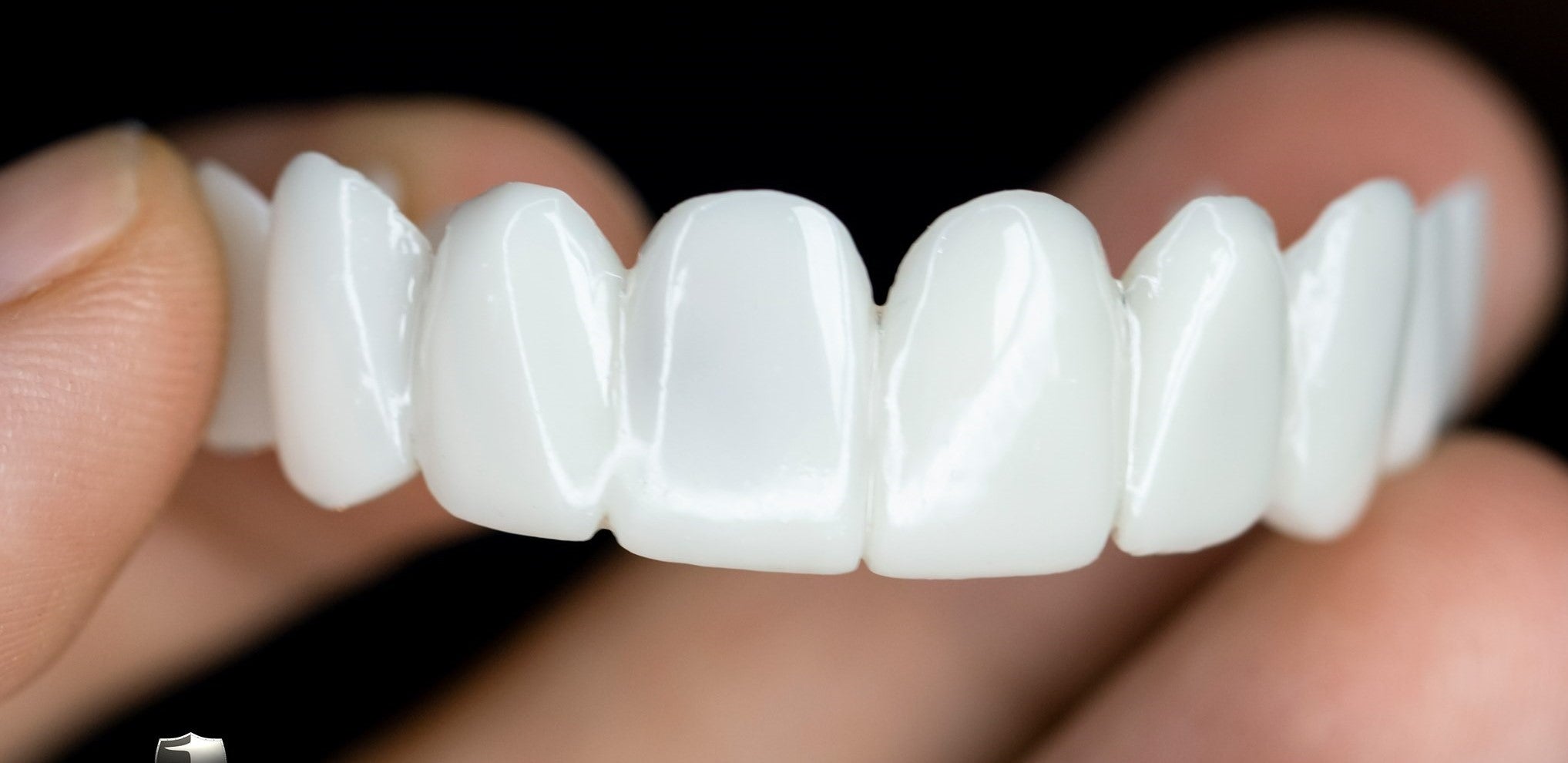 Tandprothese met Aanpasbare Lensstructuur voor Natuurlijk Uiterlijk | Sansoti
