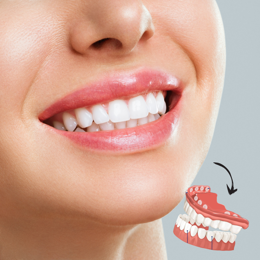 Cosmetic Denture Prosthesis for Adults, Removable Silicone Tooth Filling, Reusable, Natural White | Sansoti