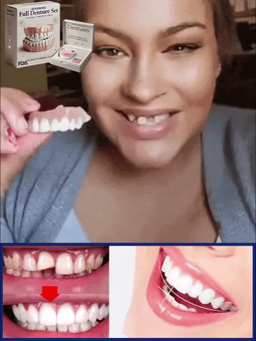 Flexible Denture Set for Upper & Lower Jaw, Reusable, Adjustable, Cosmetic Comfort for Everyday Use | Sansoti