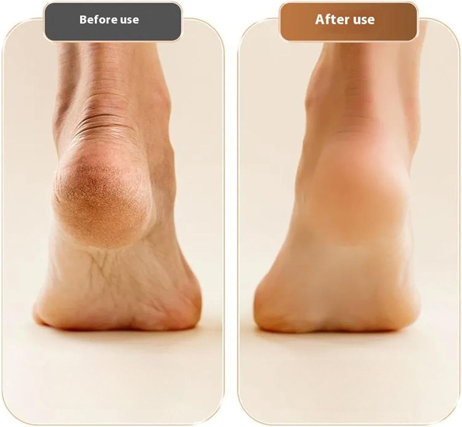 Electric Callus Remover Ergonomic Design Professional Foot Care Pedicure at Home Smooth Soft Feet | Sansoti