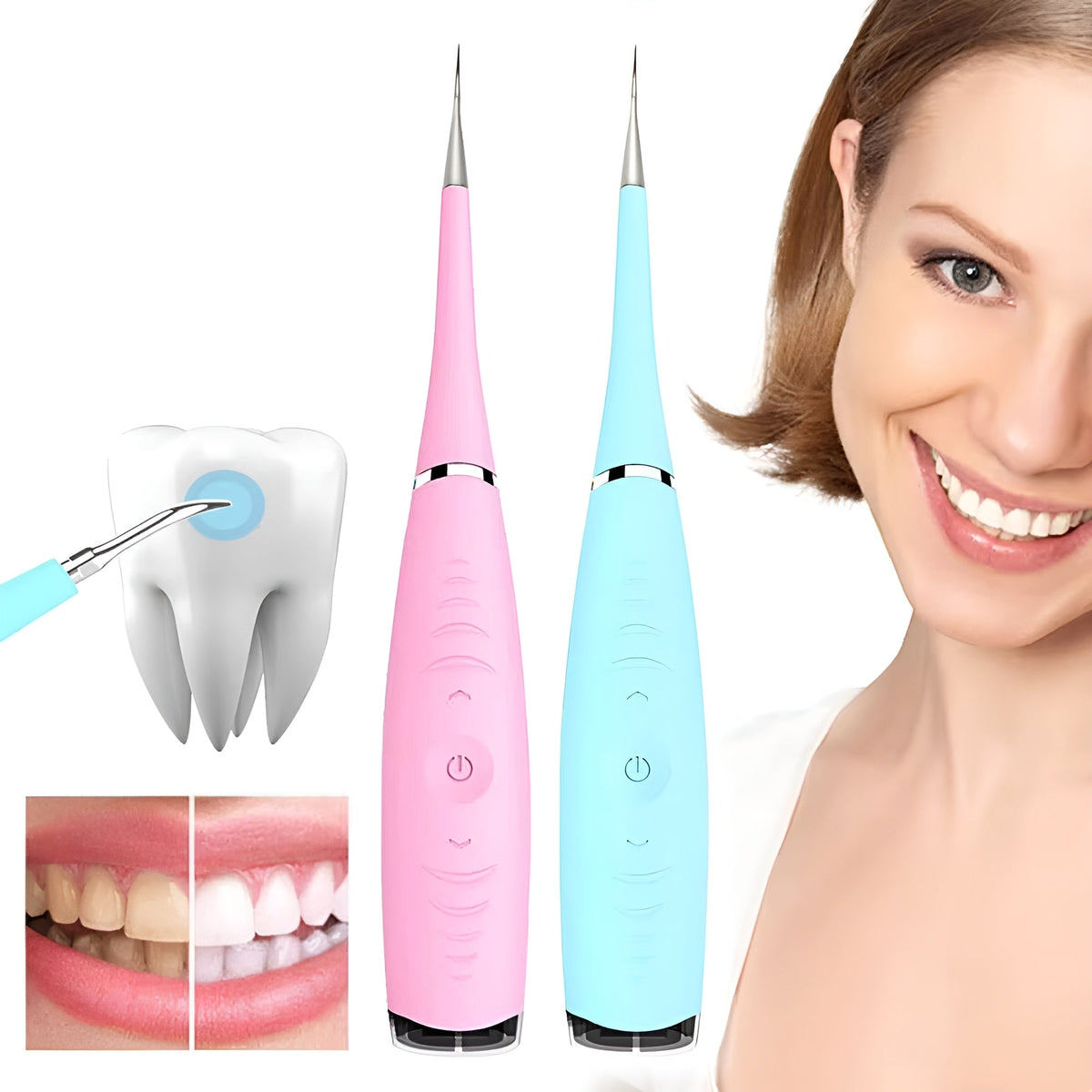 Ultrasonic Teeth Cleaner and Tartar Remover Rechargeable Stain Removal at Home Professional Oral Care | Sansoti