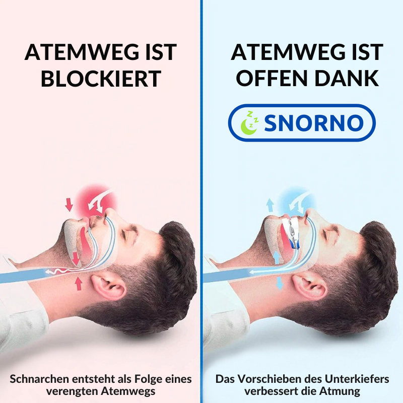 Verstelbaar Anti-Snurk Mondstuk met Ergonomische Pasvorm voor Comfortabele Nachtrust | Sansoti