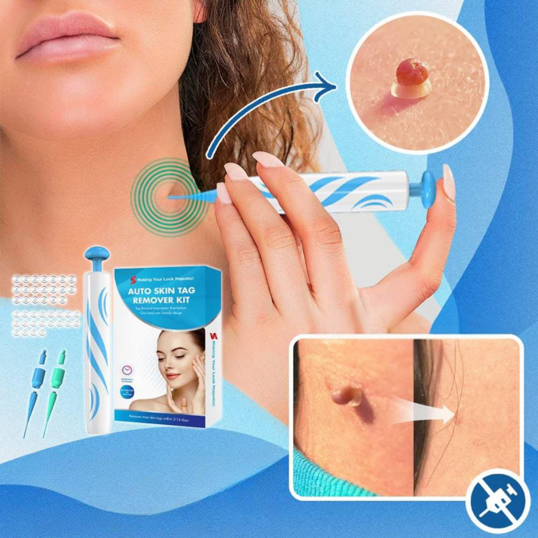 Warzenentferner Flüssigkeit 20 ml Hautpflege Behandlung für glatte Hände und Füße Hautfreundlich | Sansoti