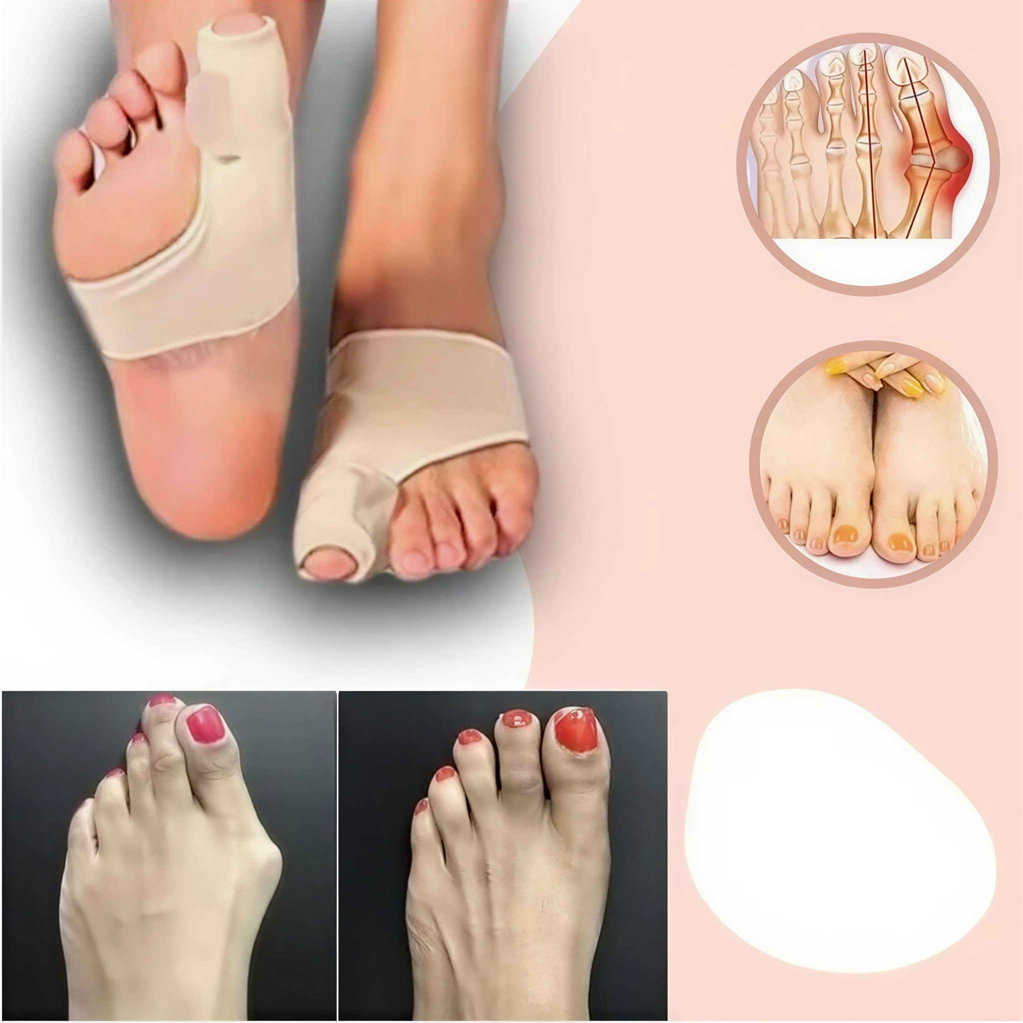 Teencorrector Hallux Valgus Gel Siliconen Voetorthese Teenstandverbetering Comfortabel Draagbaar Pijnverlichting | Sansoti