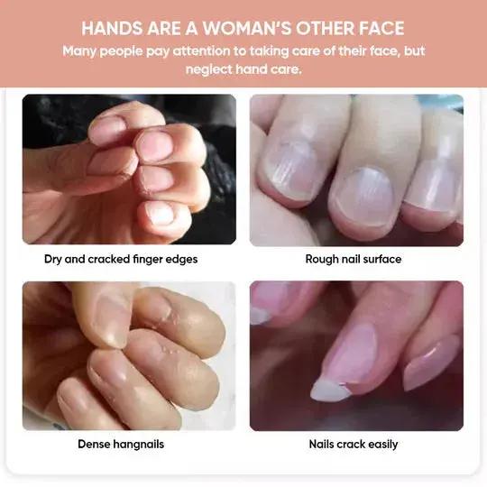 Nagelremolie voor Sterke en Glanzende Nagels 5ml | Sansoti