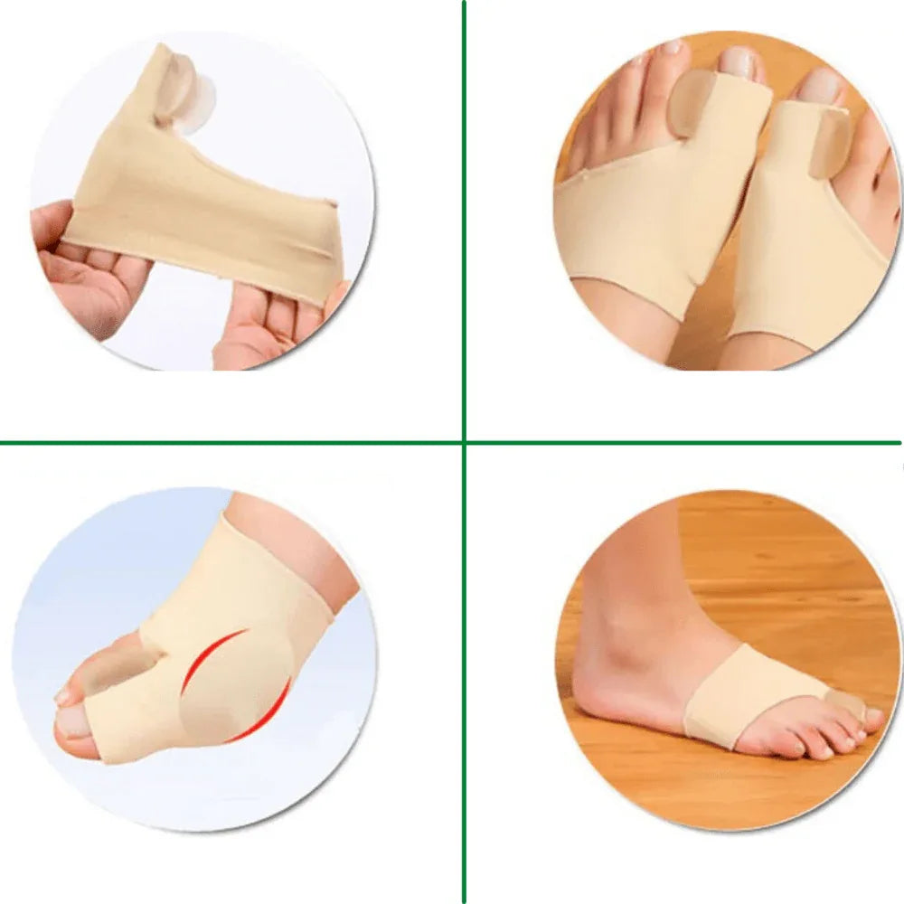 Teencorrector Hallux Valgus Gel Siliconen Voetorthese Teenstandverbetering Comfortabel Draagbaar Pijnverlichting | Sansoti