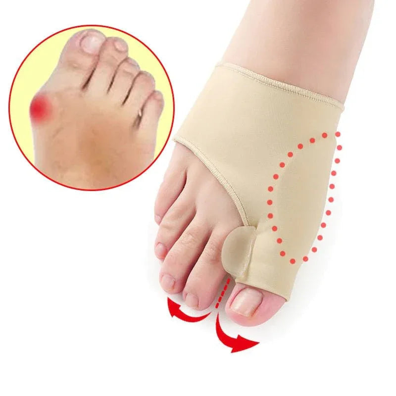 Teencorrector Hallux Valgus Gel Siliconen Voetorthese Teenstandverbetering Comfortabel Draagbaar Pijnverlichting | Sansoti