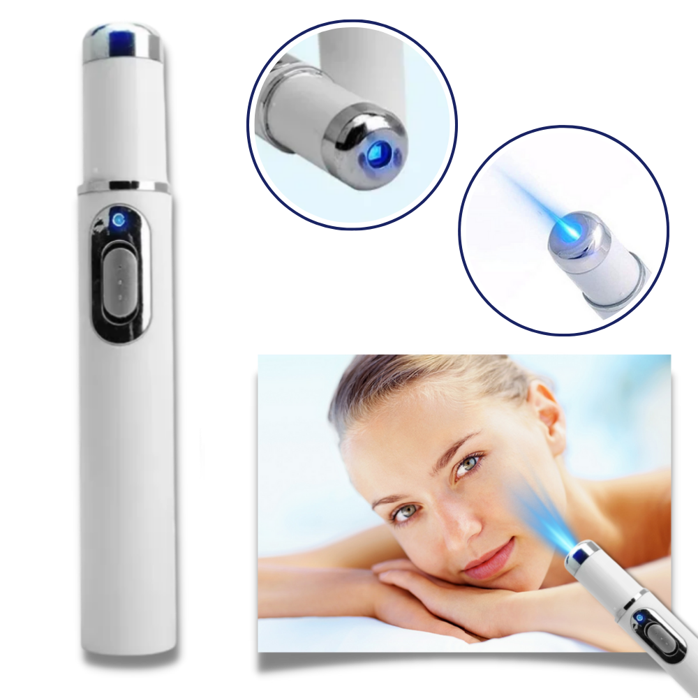 Huidverzorgingspen met Blauwe Lichttherapie tegen Pigmentvlekken en Littekens | Draagbaar Huidverjonging Apparaat voor Thuisgebruik | Precisie Laserbehandeling Hyperpigmentatie Vermindering Anti-Aging | Sansoti