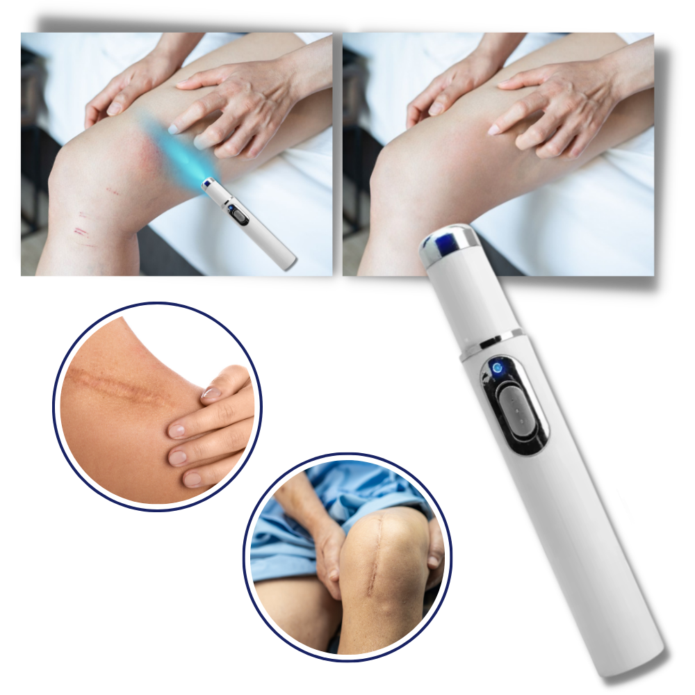 Huidverzorgingspen met Blauwe Lichttherapie tegen Pigmentvlekken en Littekens | Draagbaar Huidverjonging Apparaat voor Thuisgebruik | Precisie Laserbehandeling Hyperpigmentatie Vermindering Anti-Aging | Sansoti