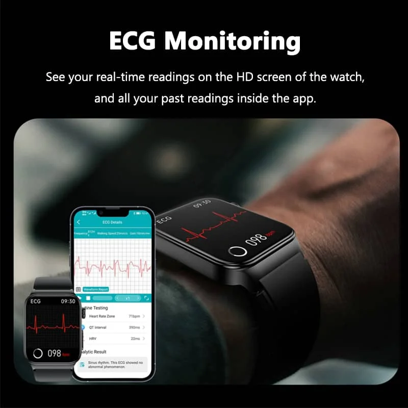 Geavanceerd Gezondheidshorloge met ECG en Bloedglucose Monitoring | Sansoti