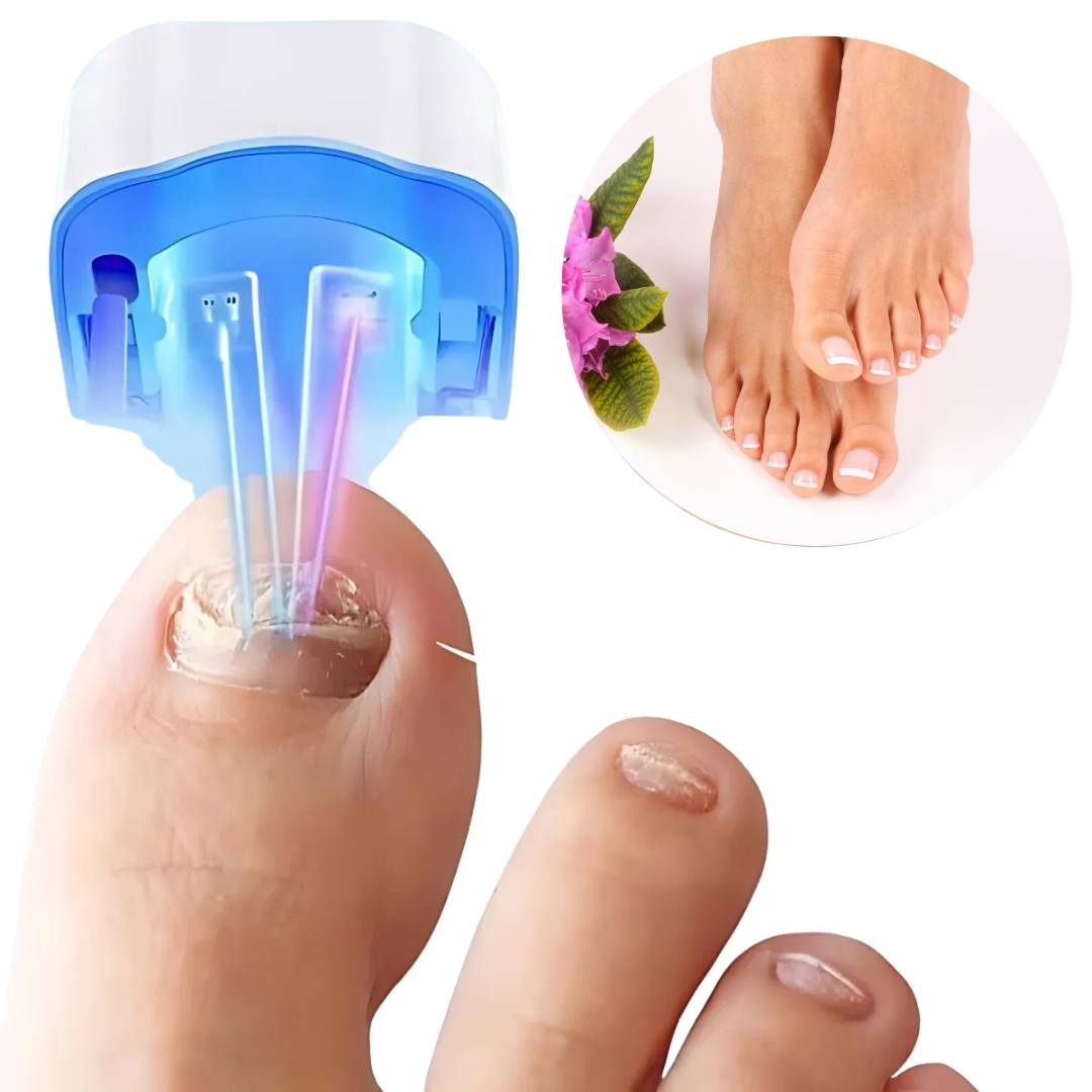 Laserapparaat Nagelschimmel Behandeling Oplaadbaar Compact Wit voor Handen en Voeten Thuisgebruik Nagelverzorging | Sansoti