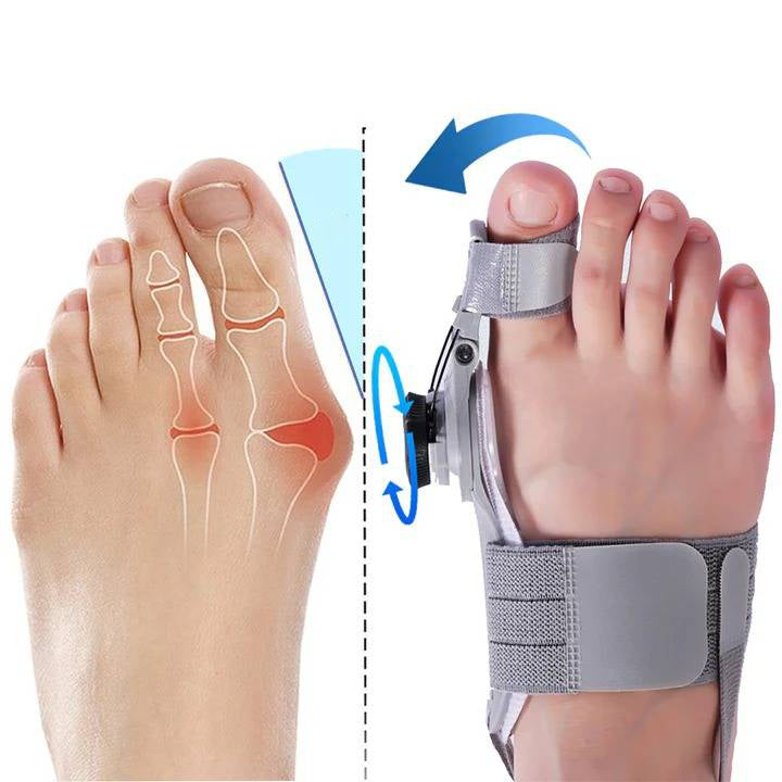 Correcteur d’orteil avec pression réglable pour le traitement de l’hallux valgus, confortable de jour comme de nuit, orthopédique | Sansoti