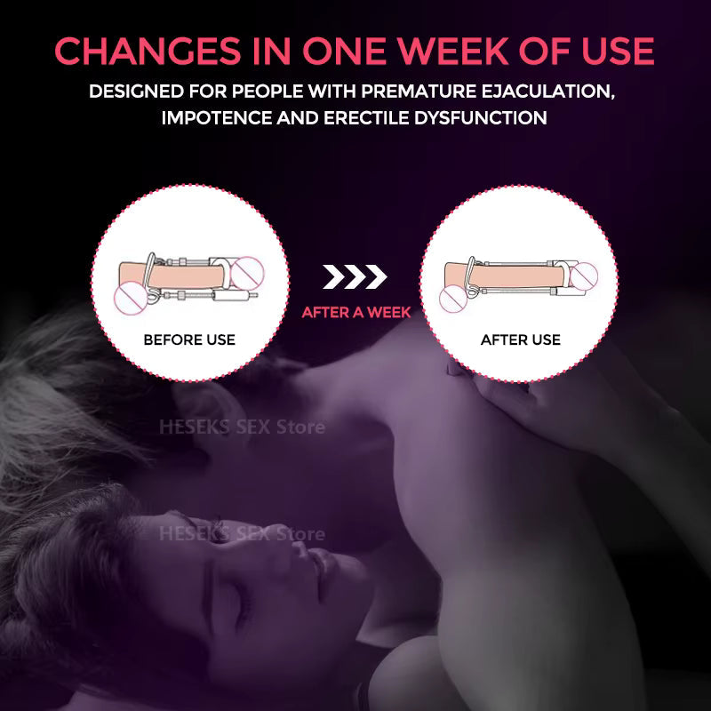 Penis Extender Traction Device for Natural Enlargement Medically Approved Comfortable Adjustable | Sansoti