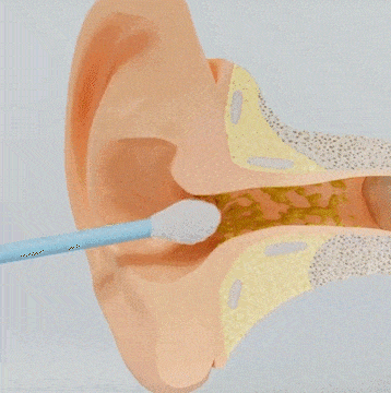 Ear Exam Camera with Silicone Cleaning Attachment and LED Lighting | Sansoti