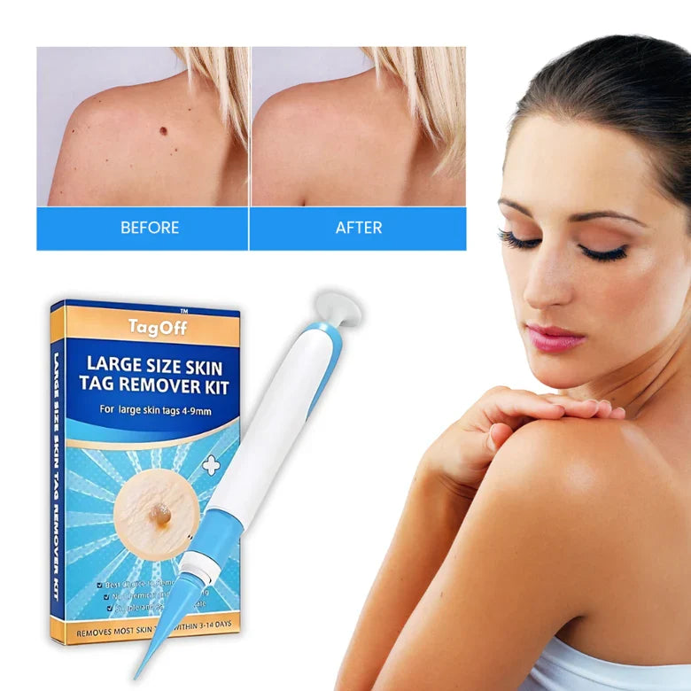 Huidverzorgingsformule 30ml met Precisie-applicator en Natuurlijk Extract voor Gerichte Huidverzorging | Sansoti