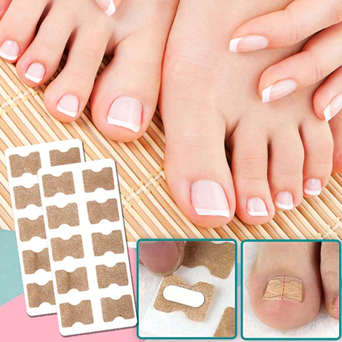Self-Adhesive Toenail Correction Strips for Nail Care with a Natural Look for At-Home Pedicures | Sansoti