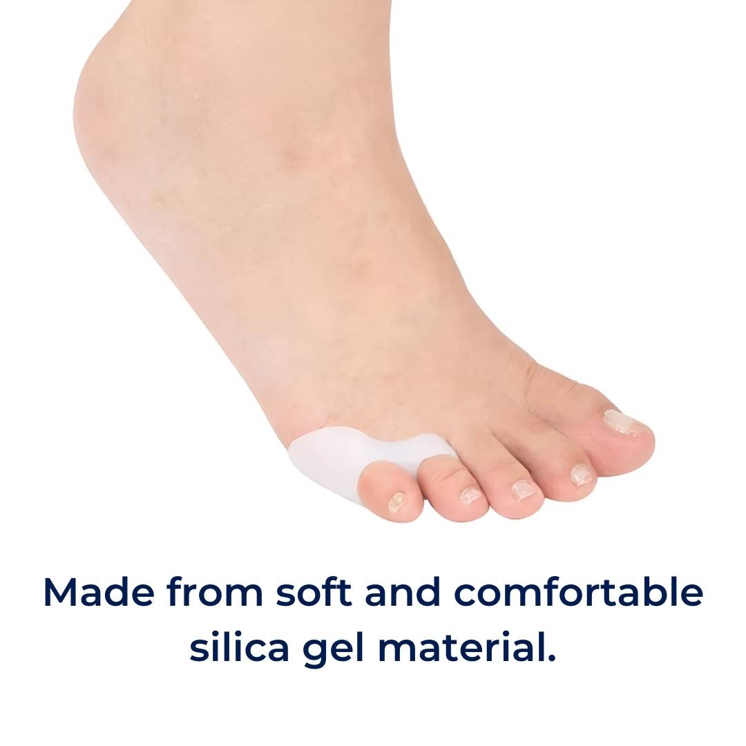 Orthopedische Teenspreiders – Correctie voor Bunions, Hamertenen en Teenuitlijning | Sansoti