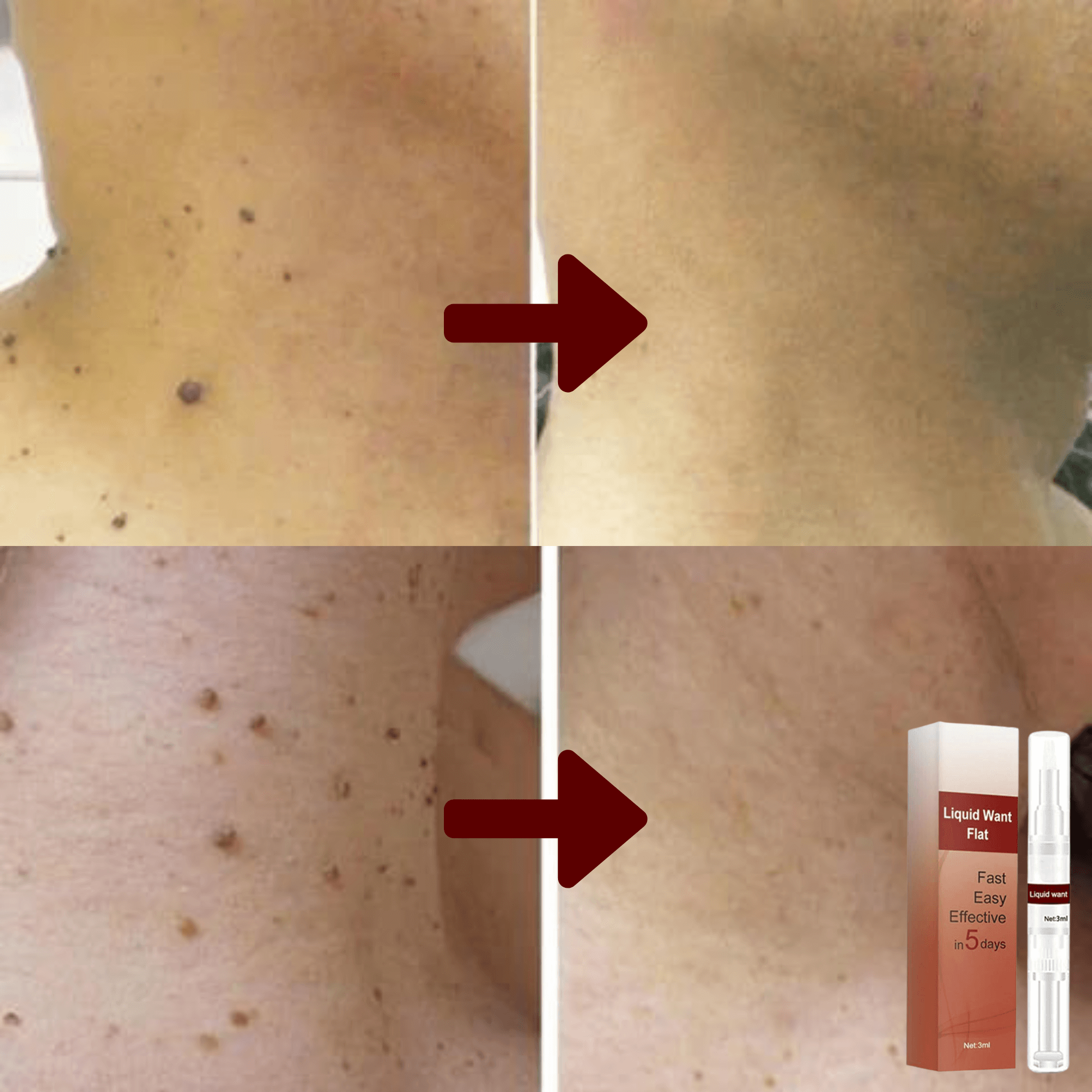 Skincare Serum for Skin Imperfections – Natural Formula – Safe & Effective | Sansoti