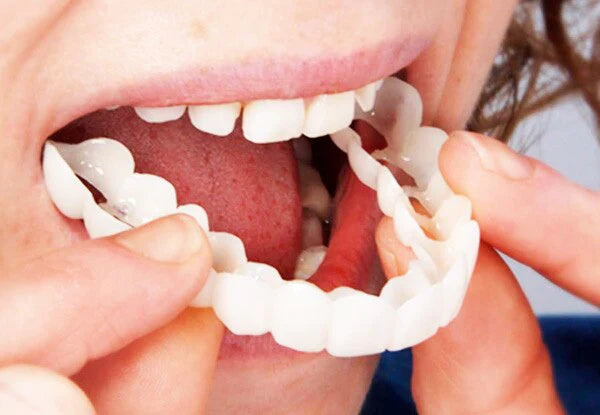 Cosmetic Denture Flexible Silicone Temporary Teeth Set for Natural Appearance | Sansoti