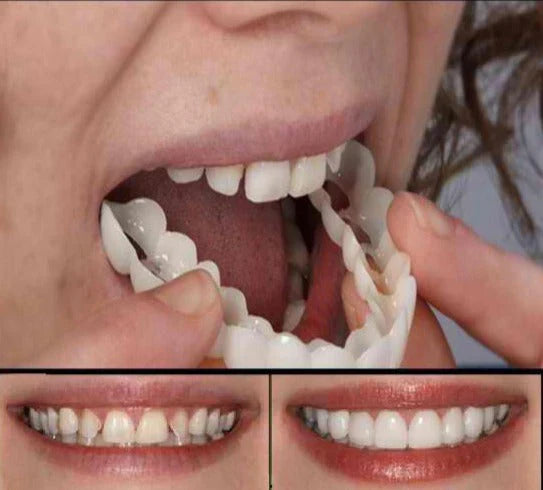 Cosmetic Denture Flexible Silicone Temporary Teeth Set for Natural Appearance | Sansoti