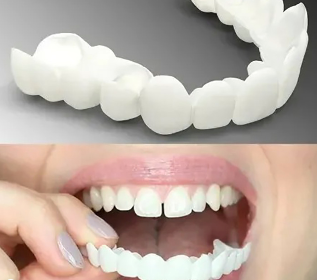 Prothèse dentaire cosmétique pour adultes – dents à clipser réglables pour un usage quotidien et les occasions spéciales | Sansoti