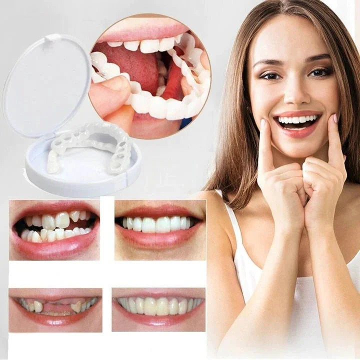 Cosmetische Tandfacet Set Boven & Onder Verstelbaar Vormbaar Herbruikbaar Natuurlijk Wit Instant Smile | Sansoti