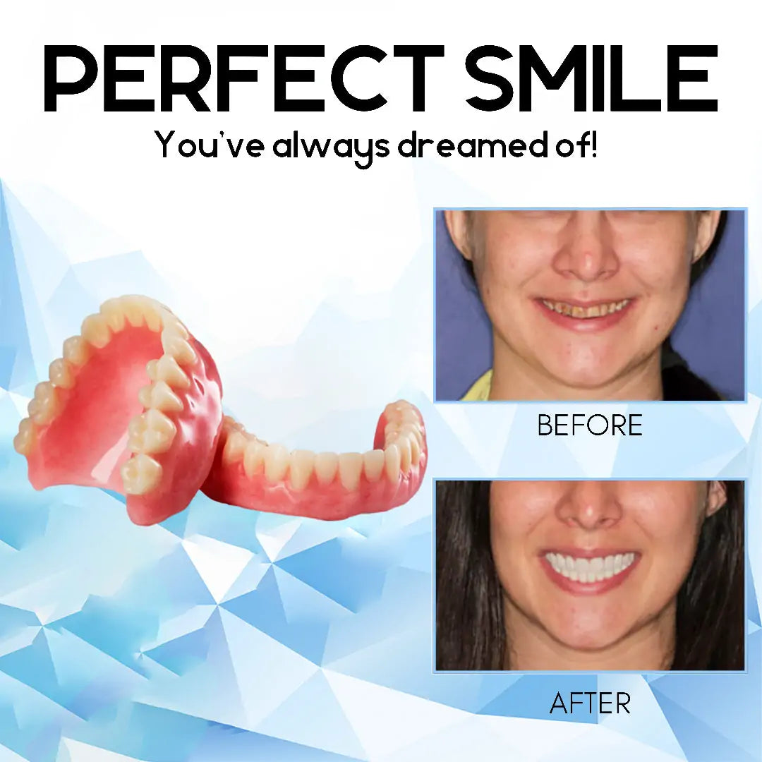Cosmetic Denture Prosthesis for Adults, Removable Silicone Tooth Filling, Reusable, Natural White | Sansoti