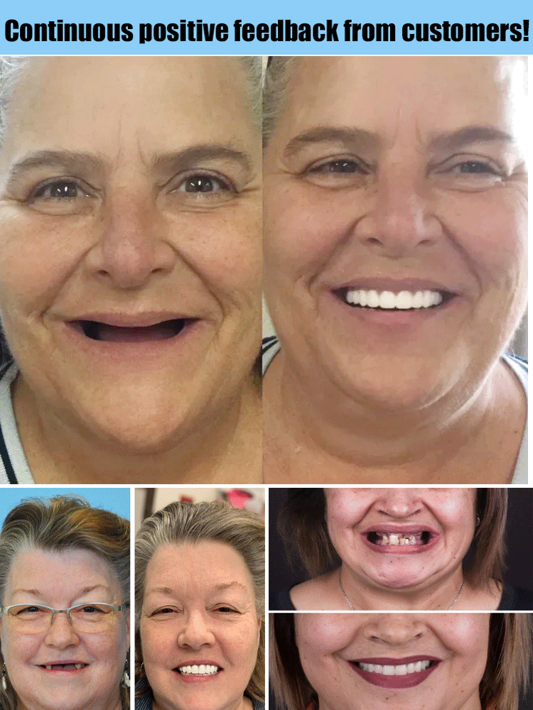 Flexible Denture Set for Upper & Lower Jaw, Reusable, Adjustable, Cosmetic Comfort for Everyday Use | Sansoti