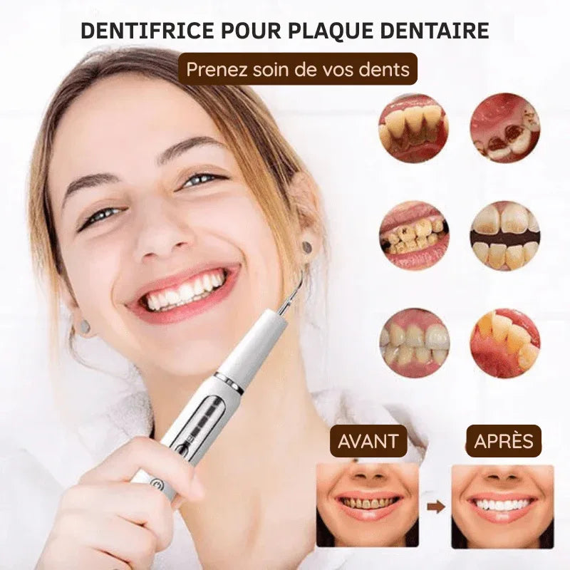 Ultrasoon Tandreiniger USB Oplaadbaar met LED-Verlichting 3 Standen voor Professionele Mondzorg Thuis Wit | Sansoti