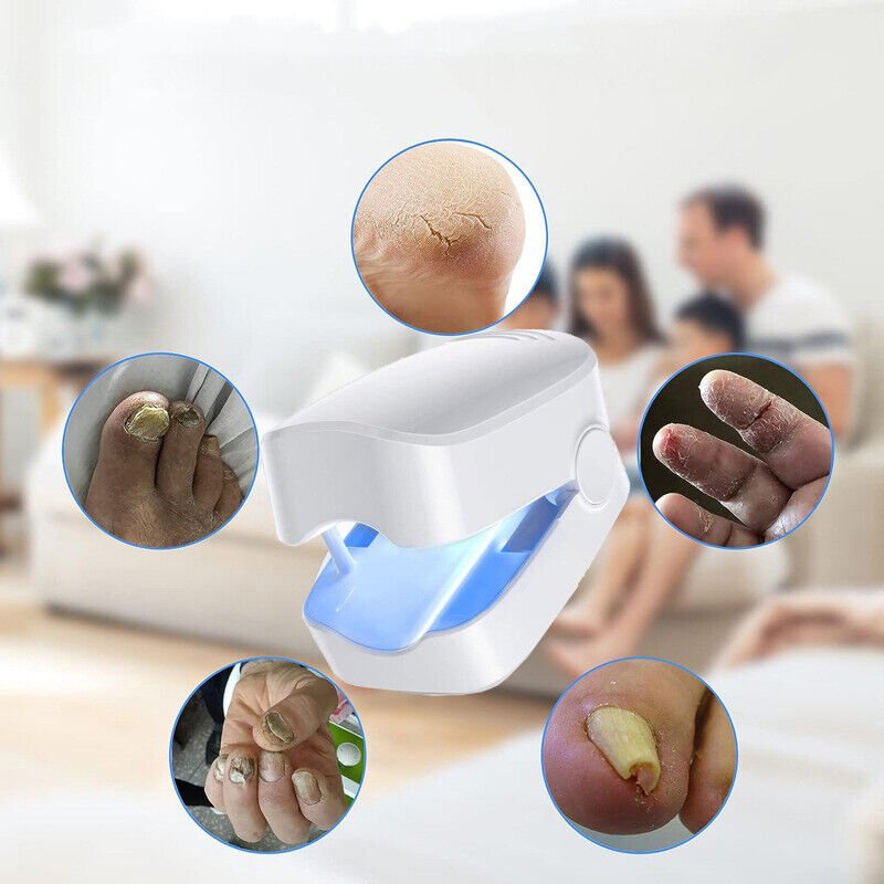 Lichttherapie Apparaat 910nm tegen Nagelschimmel Oplaadbaar USB Thuisbehandeling voor Gezonde Nagels | Sansoti