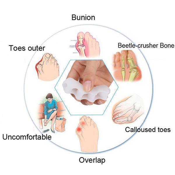 Correcteur orthopédique d’orteils en silicone, séparateur d’orteils pour correction de l’hallux valgus et des oignons, pour la rééducation du pied | Sansoti