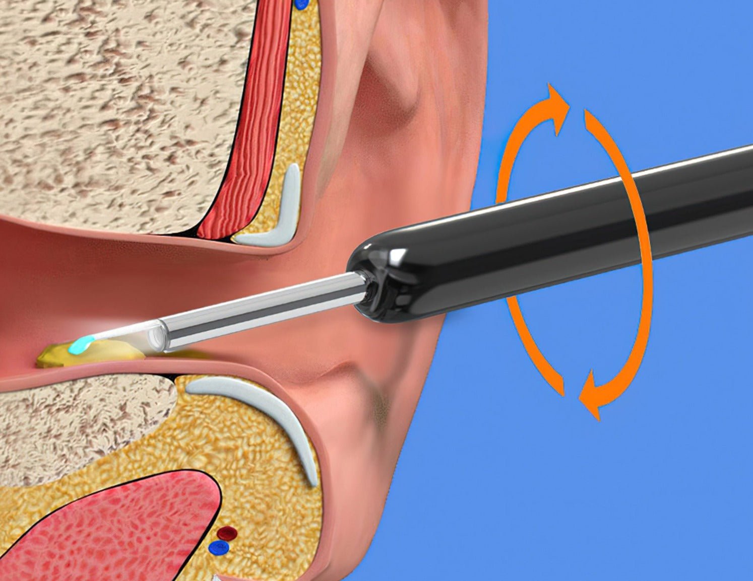 Ear Exam Camera with Silicone Cleaning Attachment and LED Lighting | Sansoti