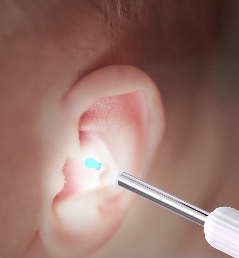 Ear Exam Camera with Silicone Cleaning Attachment and LED Lighting | Sansoti