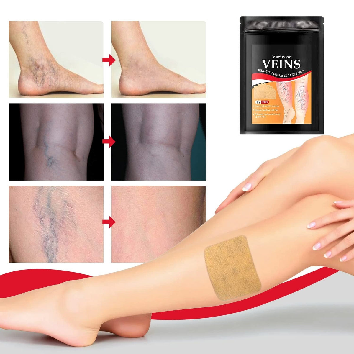 Hydrogel Pleisters voor Zware Benen en Spataders Natuurlijke Verzorging Verlichting 10 Stuks Wellness | Sansoti